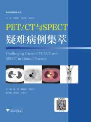 PET/CT与SPECT疑难病例集萃
