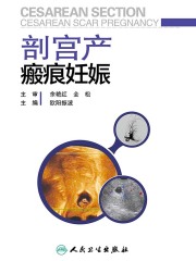 剖宫产瘢痕妊娠
