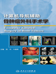 计算机导航辅助骨肿瘤外科手术学