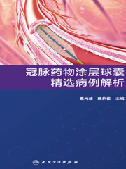 冠脉药物涂层球囊精选病例解析