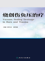 烧创伤负压治疗