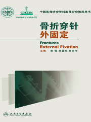 骨折穿针外固定