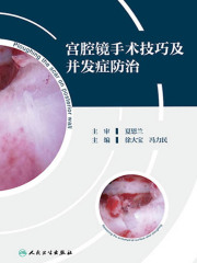 宫腔镜手术技巧及并发症防治
