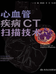 心血管疾病CT扫描技术