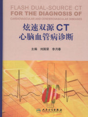 炫速双源CT心脑血管病诊断