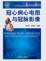 冠心病心电图与冠脉影像
