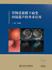 胃肠道黏膜下病变内镜超声检查术应用