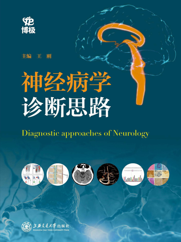 神经病学诊断思路