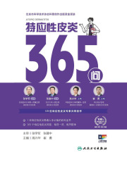 特应性皮炎365问